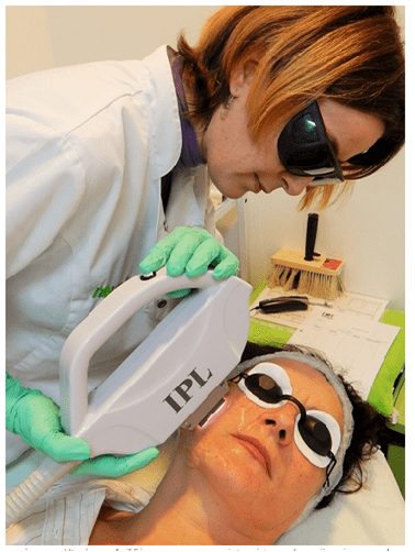 Nomasvello (No+Vello)-lider mondial in epilare definitiva cu IPL