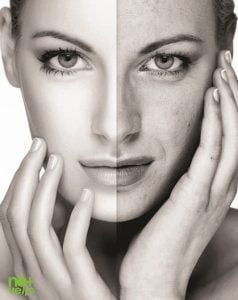 Tratament facial puncte negre Nomasvello