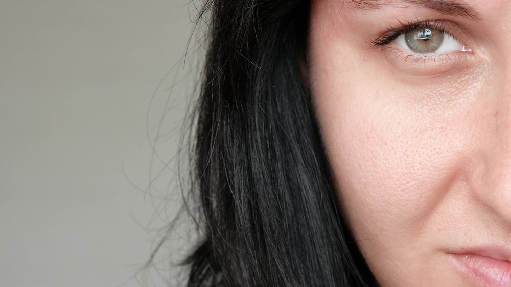 Cauzele dilatarii porilor