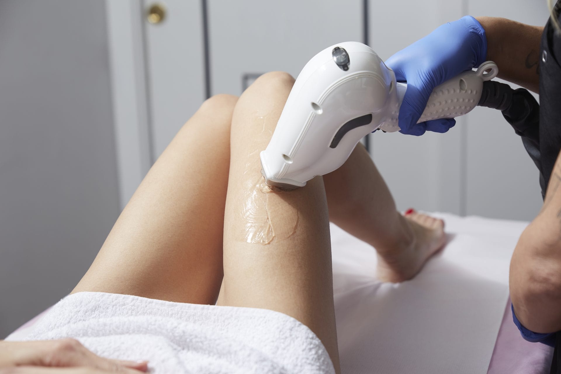 beneficii epilare ipl00001 Epilare IPL in saloanele Nomasvello